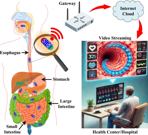 ‘Wi-Fi-Based Wireless Capsule Endoscopy’ Developed Using Next-Generation Communication Technology(ISAC)