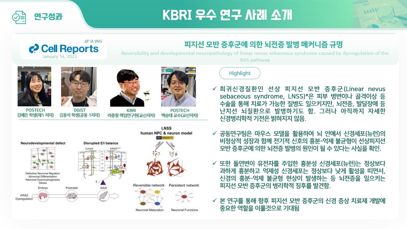 피지선 모반 증후군에 의한 뇌전증 발명 메커니즘 규명